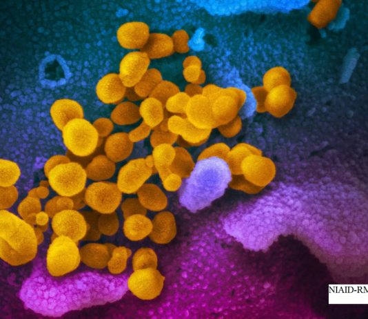 Coronavirus: Nobody likes epidemics, but don’t demonise countries